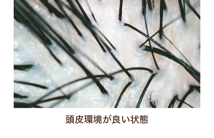 頭皮環境が良い状態