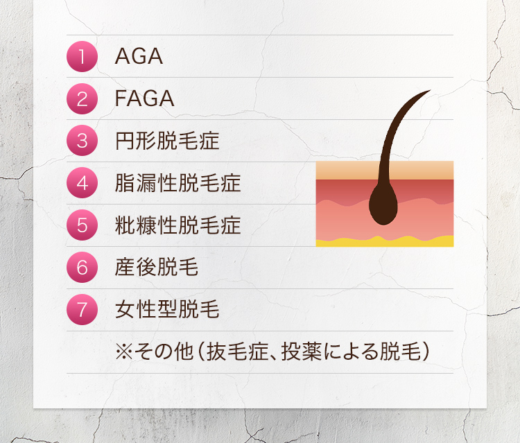 1.AGA 2.FAGA 3.円形脱毛症 4.脂漏性脱毛症 5.粃糠性脱毛症 6.産後脱毛 7.女性型脱毛※その他（抜毛症、投薬による脱毛）